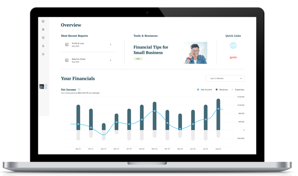 xendoo Insights dashboard takes the guess work out of business finances shows small business owners their numbers so they can grow and scale quickly. 